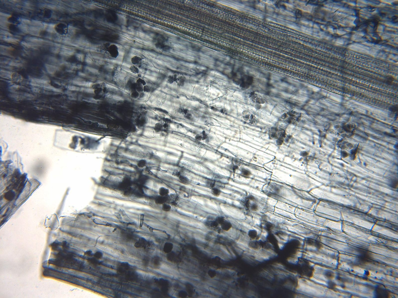 Arbuscular mycorrhiza under the microscope: flax root cortical cells containing paired arbuscules.